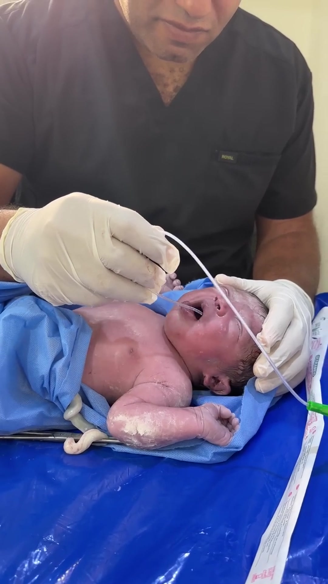 Video thumbnail for New baby born baby(720P_HD)