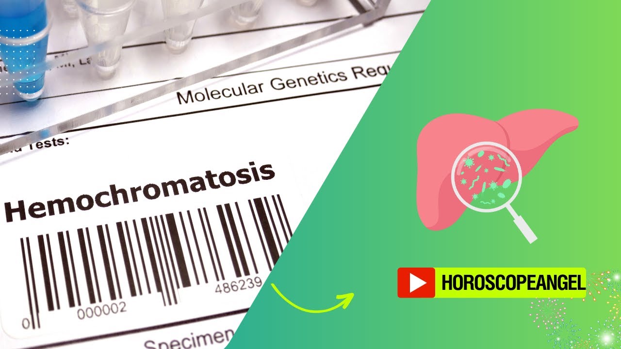 'Video thumbnail for How to treat hemochromatosis? video blog'