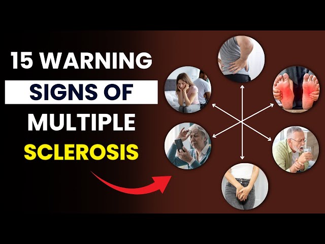 Video thumbnail for 5 Hidden Symptoms of Multiple Sclerosis You Should Never Ignore | Early Signs of Multiple Sclerosis