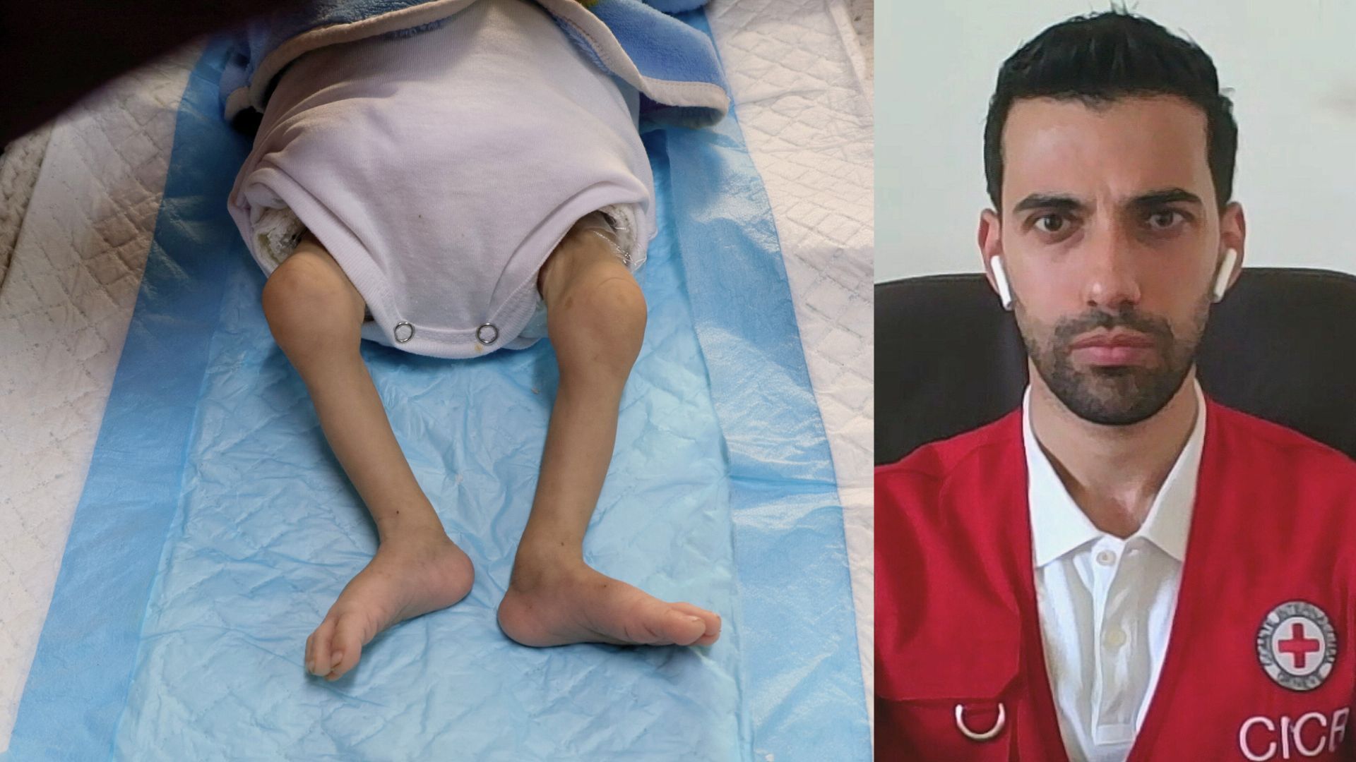 'Video thumbnail for Acute malnutrition impacting everyone in Gaza, especially children: ICRC'
