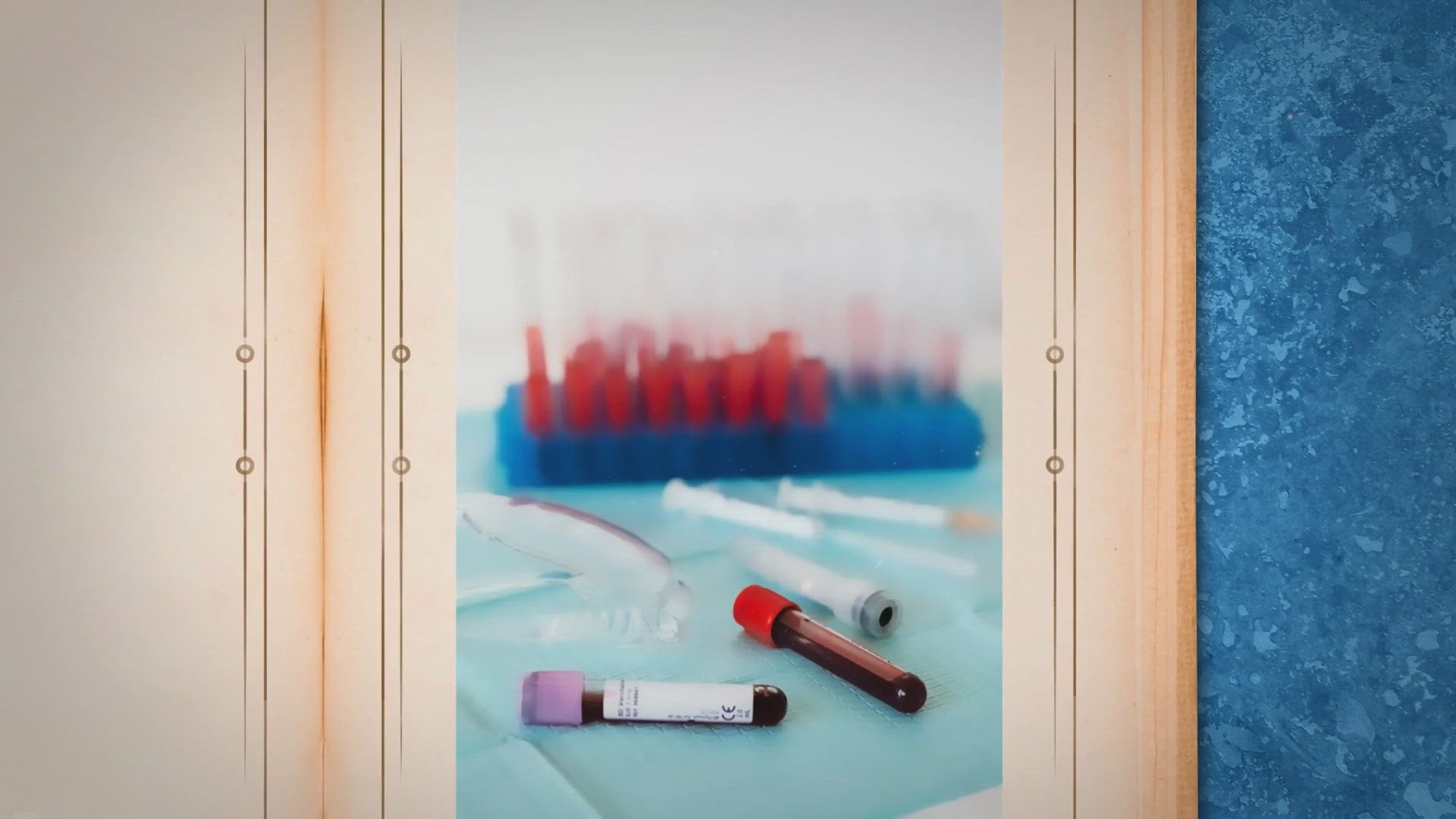 Video thumbnail for Best 5 Smartwatches With An Oxygen Sensor of 2022