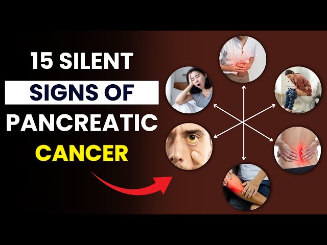 Video thumbnail for 15 Silent Signs of Pancreatic Cancer You Should NEVER Ignore | Early Symptoms of Pancreatic Cancer