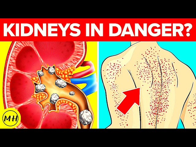 Video thumbnail for 12 Signs That Your Kidneys Need Help