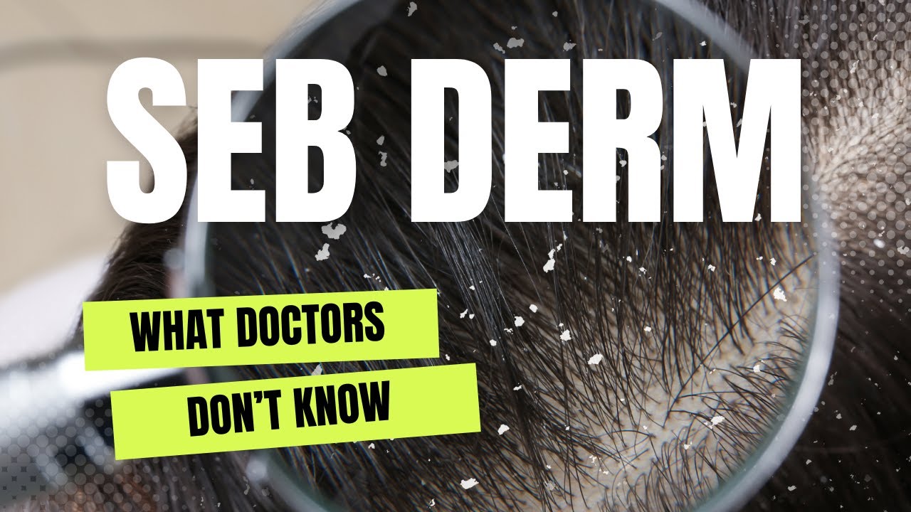Video thumbnail for What is Seborrheic Dermatitis?