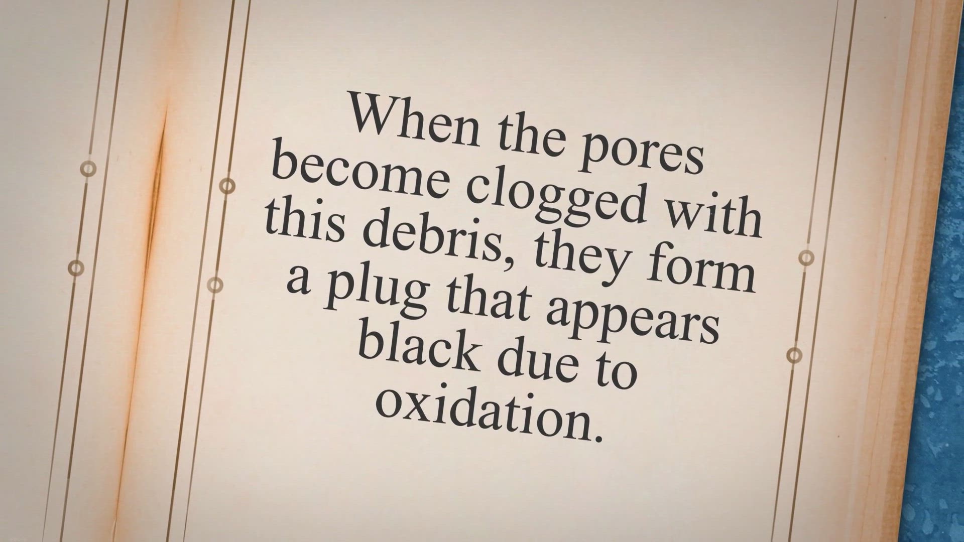Video thumbnail for Say Goodbye to Blackheads: A Comprehensive Guide to Removing Them at Home