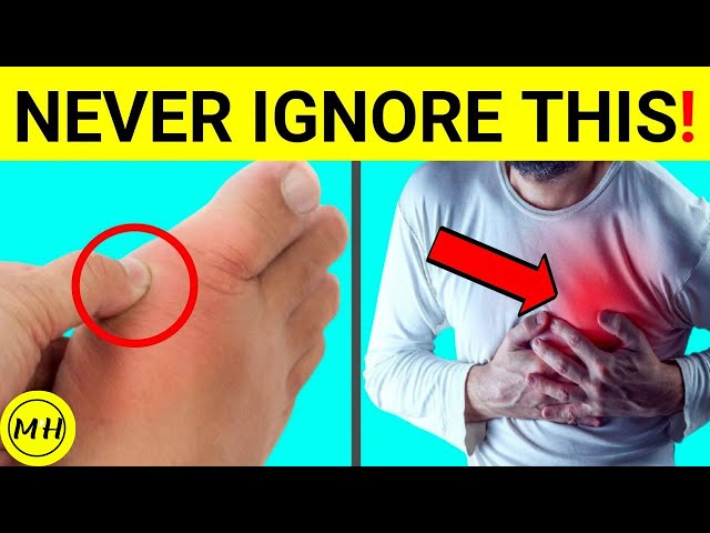 Video thumbnail for 9 Signs Of High Blood Pressure You Should NEVER IGNORE