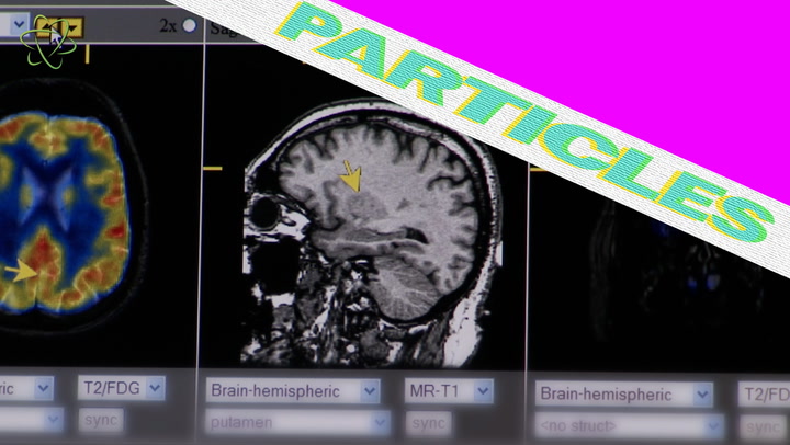 Video thumbnail for Brain Shrinkage Linked To COVID-19