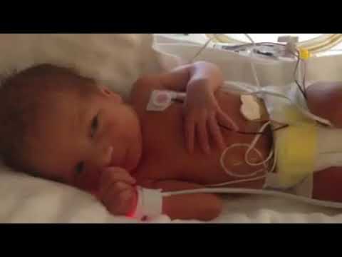 Video thumbnail for Angel bebe prematuro
