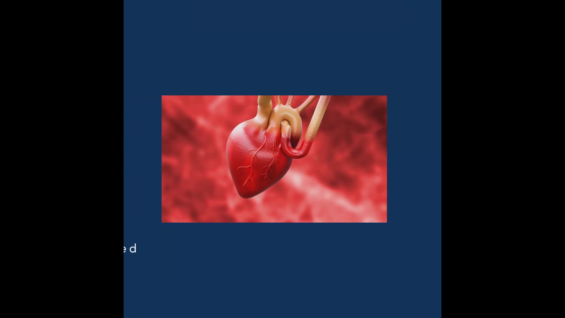 'Video thumbnail for Superfood Avocado'