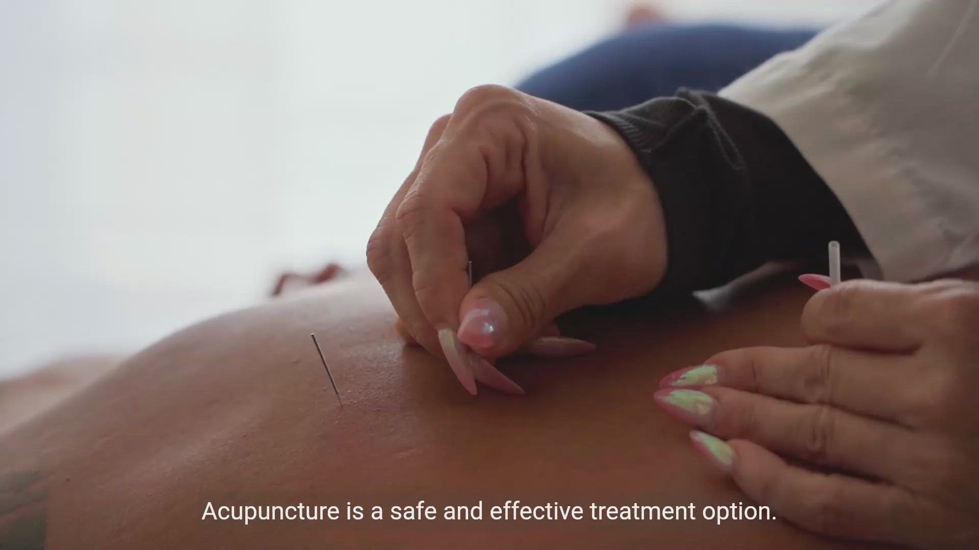 'Video thumbnail for The Power of Acupuncture: Transforming Children's health'