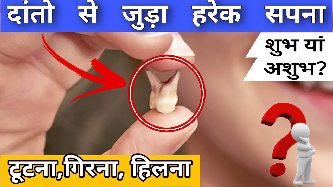 Video thumbnail for सपने में दांत दिखने का मतलब, sapne me dant girte dekhna