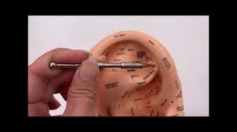 Video thumbnail for Ear Acupuncture Point For Sympathetic Nerve