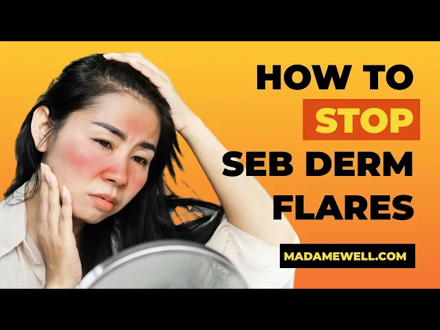 Video thumbnail for The Secret To Stopping A Seb Derm Flare