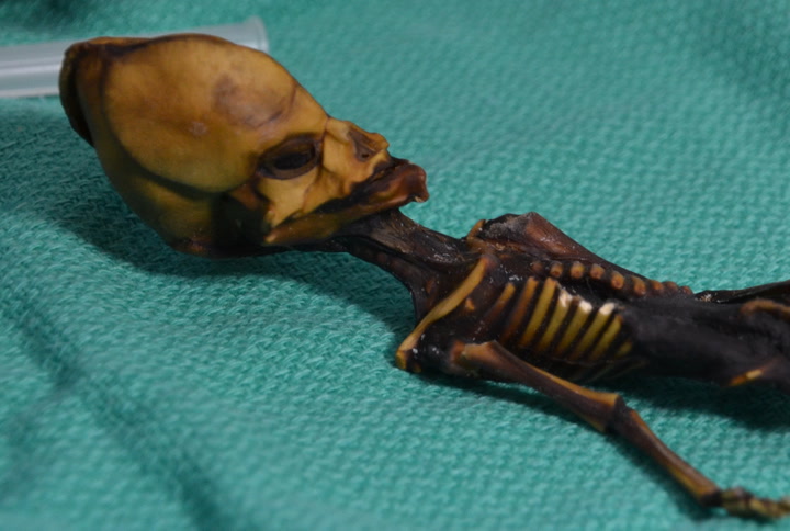 Video thumbnail for This Weird Skeleton Is Definitely Not An Alien