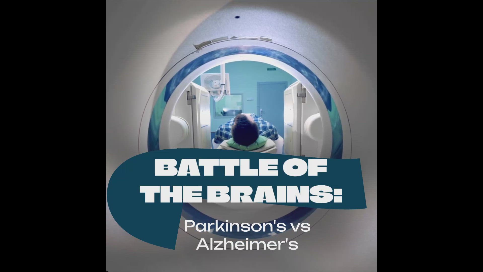 'Video thumbnail for Battle of the Brains: Parkinson's vs Alzheimer's'