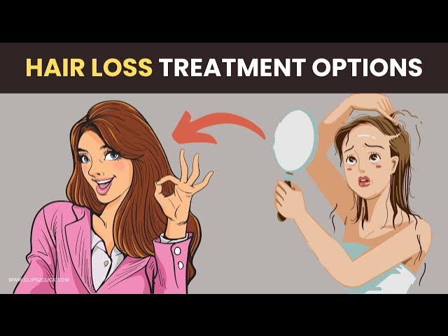 'Video thumbnail for Stop Hair Loss Now! Effective Hair Loss Treatments for Men & Women'