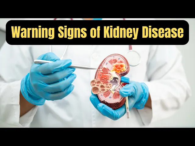 Video thumbnail for Are You IGNORING These Silent Kidney Disease Signals? Nazish