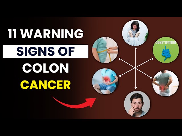 Video thumbnail for Top 11 Colon Cancer Symptoms You Should NEVER Ignore | Early Warning Signs of Colon Cancer