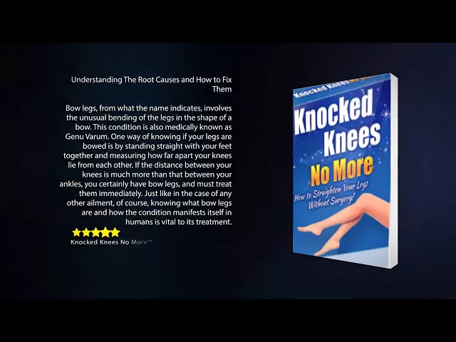 'Video thumbnail for Knocked Knees No More™ Review'