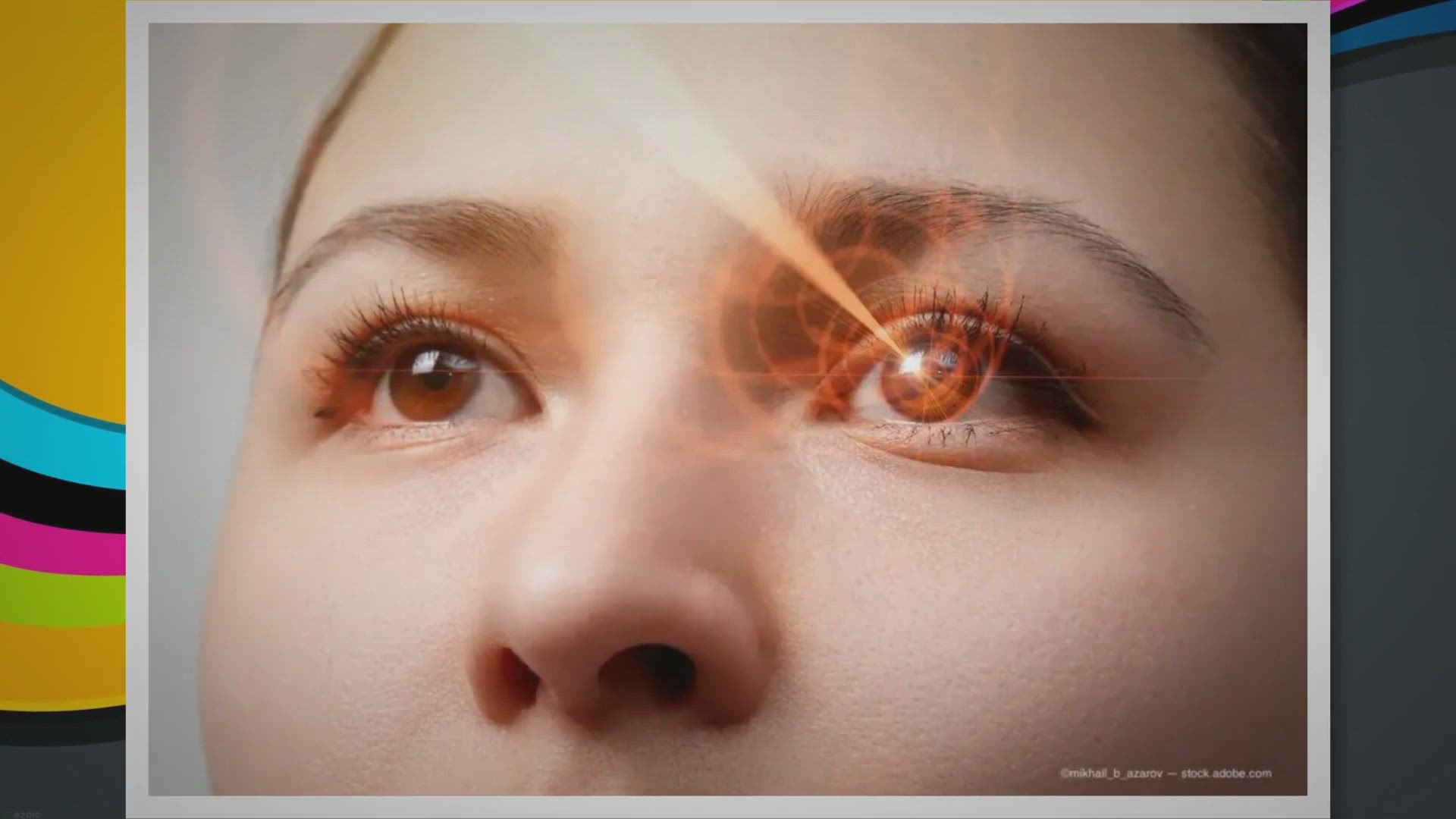'Video thumbnail for LaZrPlastique: LASIK without cutting the cornea - Eye Care'