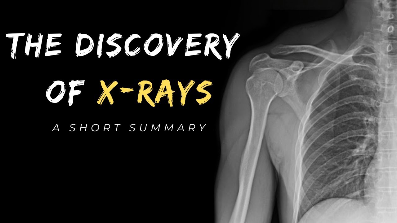 Video thumbnail for The Discovery of X Rays.