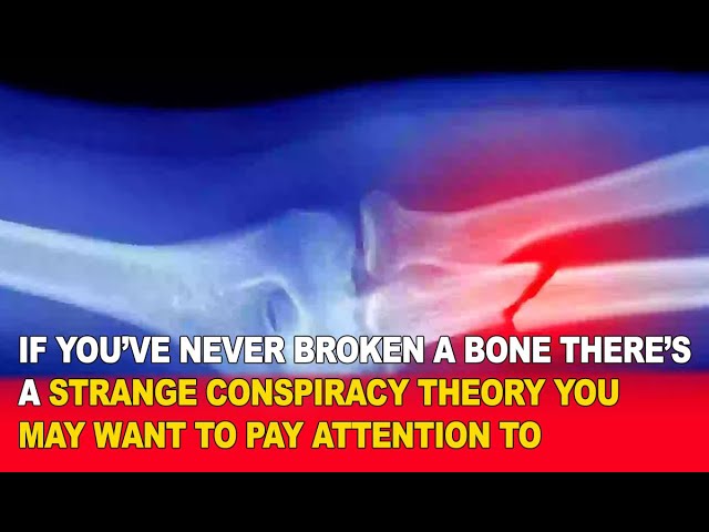 video of: If You’ve Never Broken a Bone, This Strange Conspiracy Theory Will Blow Your Mind! 🦴🤯