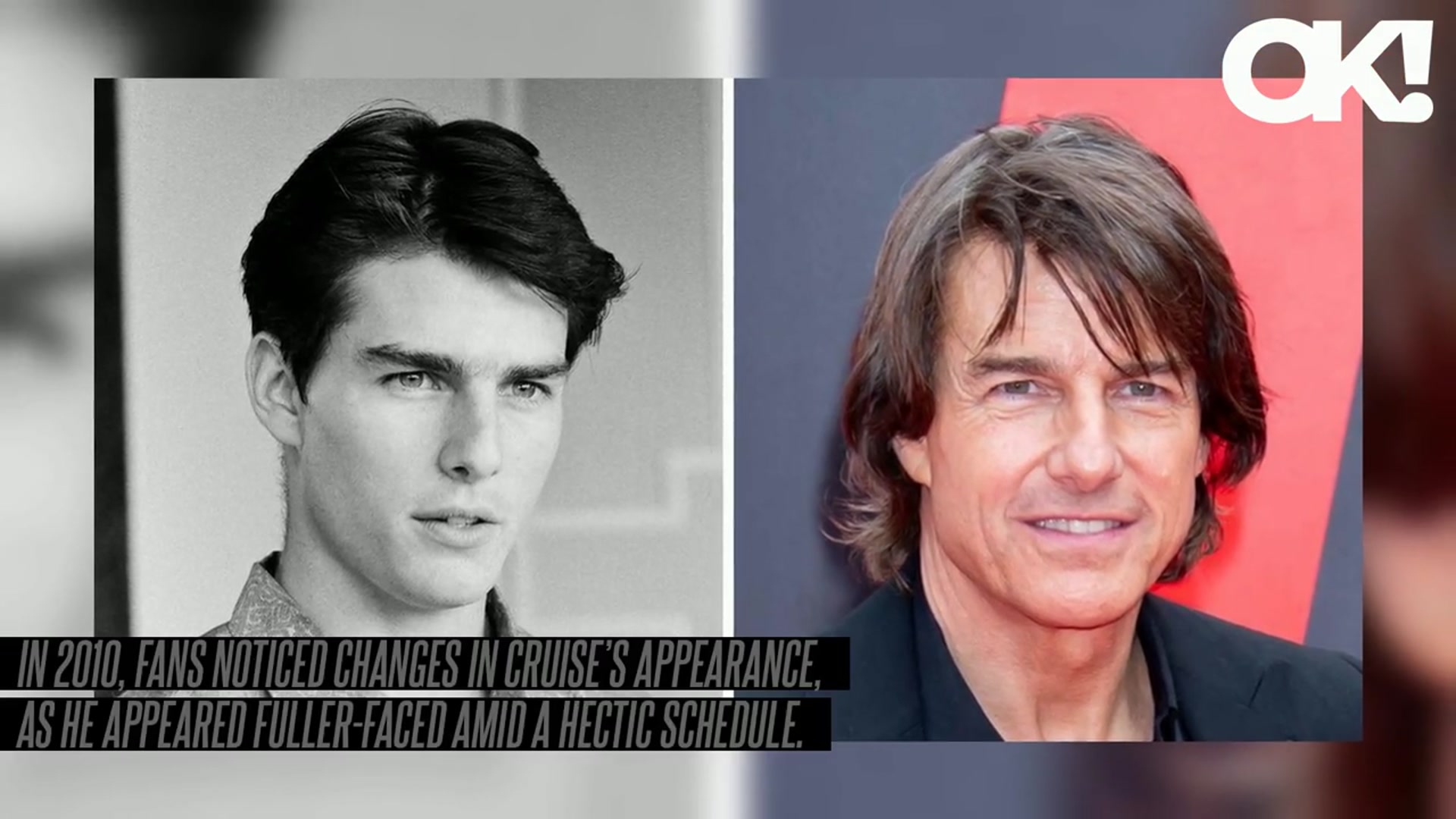 'Video thumbnail for Has Tom Cruise Had Plastic Surgery? See Before and After Photos of His Striking Transformation Amid Rumors'