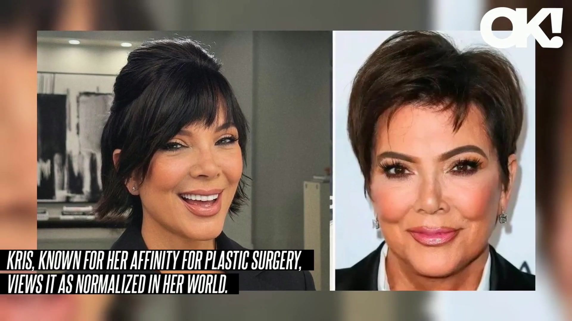 'Video thumbnail for Kris Jenner Is 'Bragging' About How Her 'Doctor Is a Total Magician' After Successful Facelift'