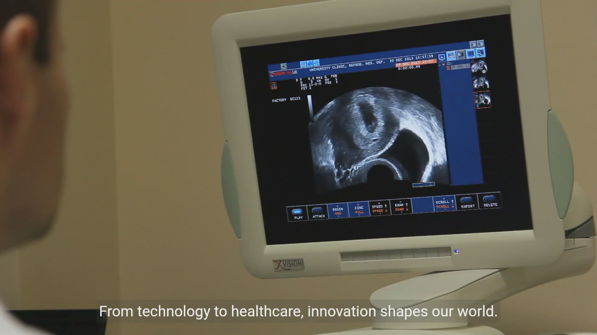 'Video thumbnail for Exploring Innovation in Various Industries'