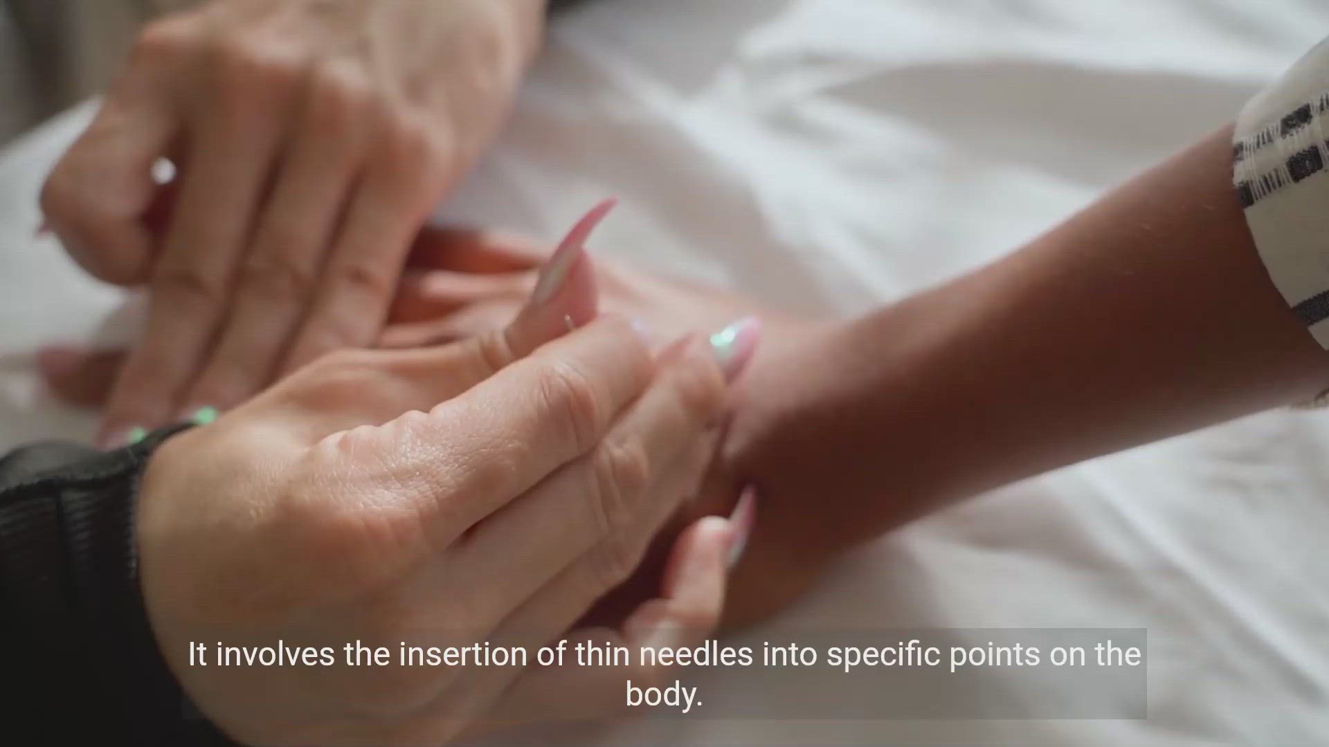 'Video thumbnail for Exploring Acupuncture and Traditional Chinese Medications'