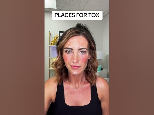 Video thumbnail for Some of the many places to have tox to help prevent and reduce fine lines and wrinkles!