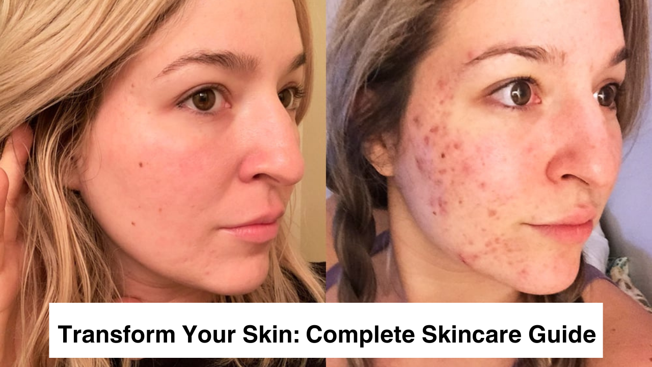 'Video thumbnail for Transform Your Skin_ The Complete Skincare Guide'