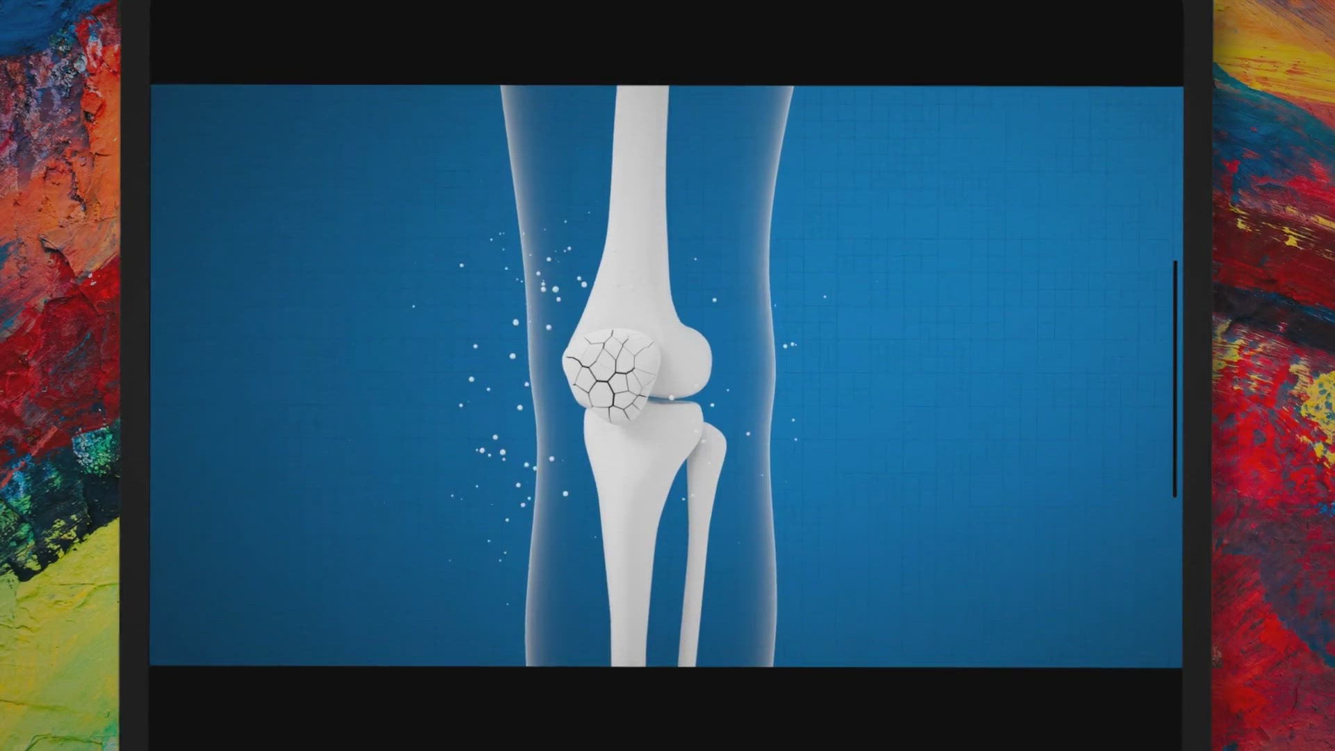 Video thumbnail for Vitamin D Deficiency – Causes, Symptoms, And Treatment