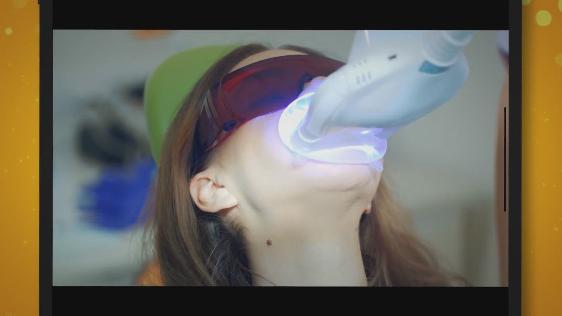 Video thumbnail for Weiße Diät nach Bleaching – Was kannst du nach dem Bleaching essen?