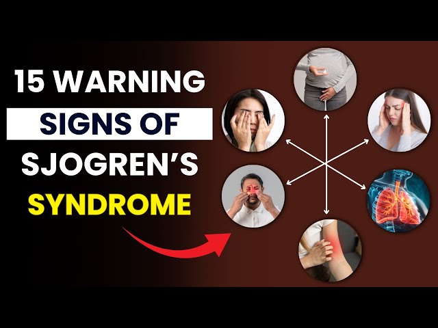 Video thumbnail for 15 Silent Symptoms of Sjogren's Syndrome You Shouldn’t Ignore | Early Signs of Sjogren's Syndrome