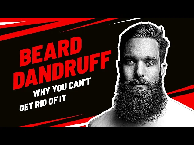Video thumbnail for The 5 Reasons Why You Have Beard Dandruff