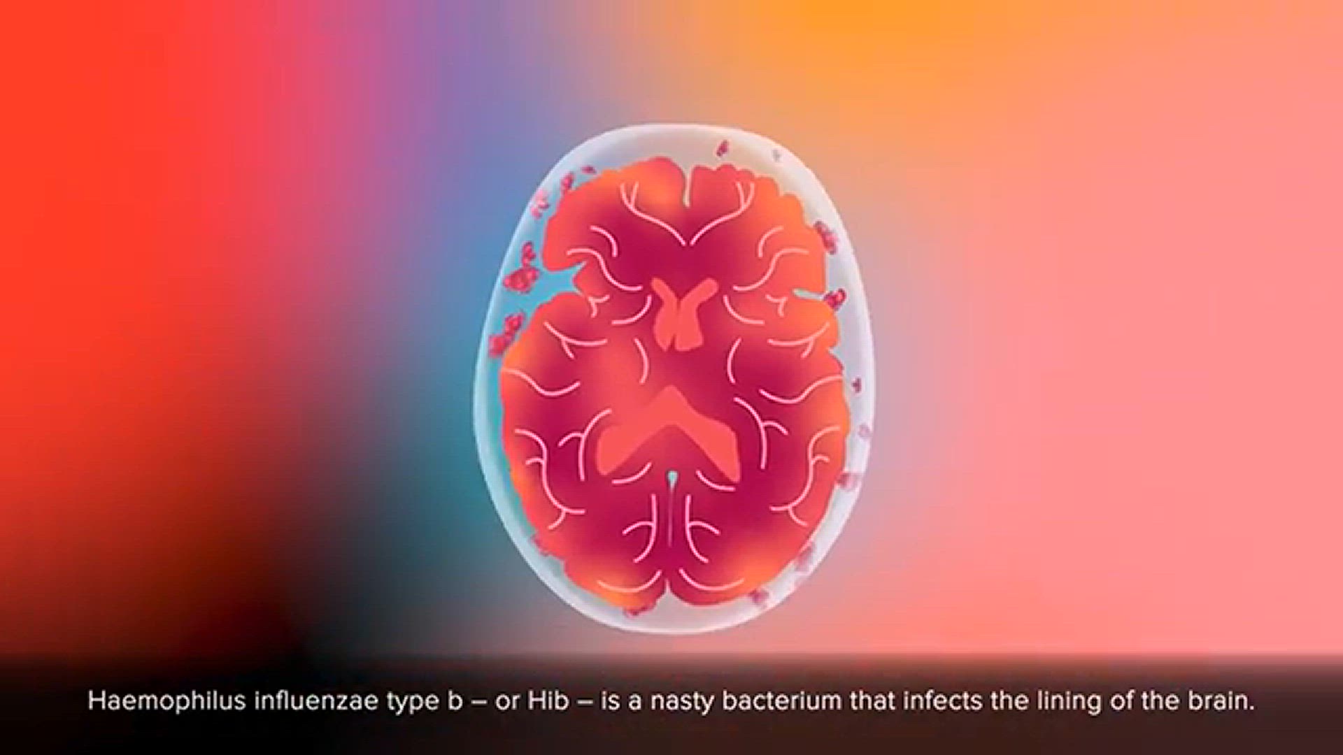Video thumbnail for Why Should You Get the Hib Vaccine
