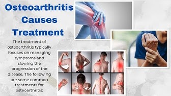 Video thumbnail for Treatment of  Osteoarthritis #RemediesOfOsteoarthritis  #howtotreatarthritispain