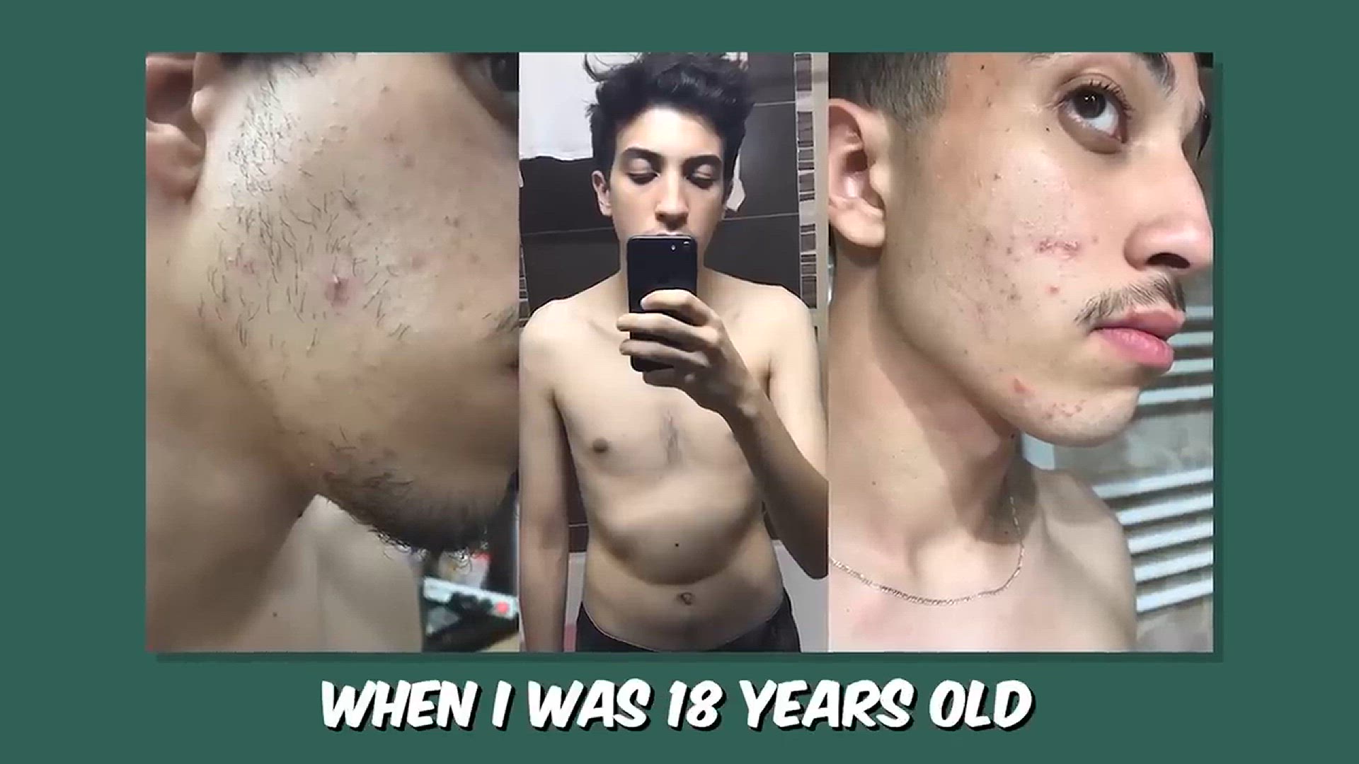 'Video thumbnail for how to get clear skin for guys asap '