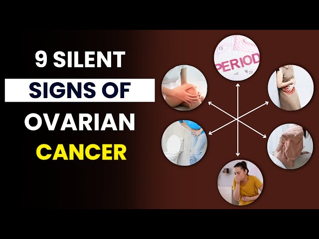 Video thumbnail for 12 Silent Symptoms of Ovarian Cancer You Must Know | Early Symptoms of Ovarian Cancer