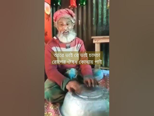 Video thumbnail for আরে ভাই রে ভাই চামচা রোগের ঔষধ কোথায় পাই