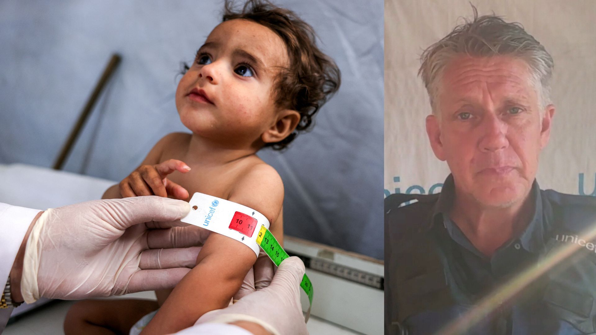 'Video thumbnail for UNICEF spokesman ‘shocked’ by extent of malnutrition in Gaza'
