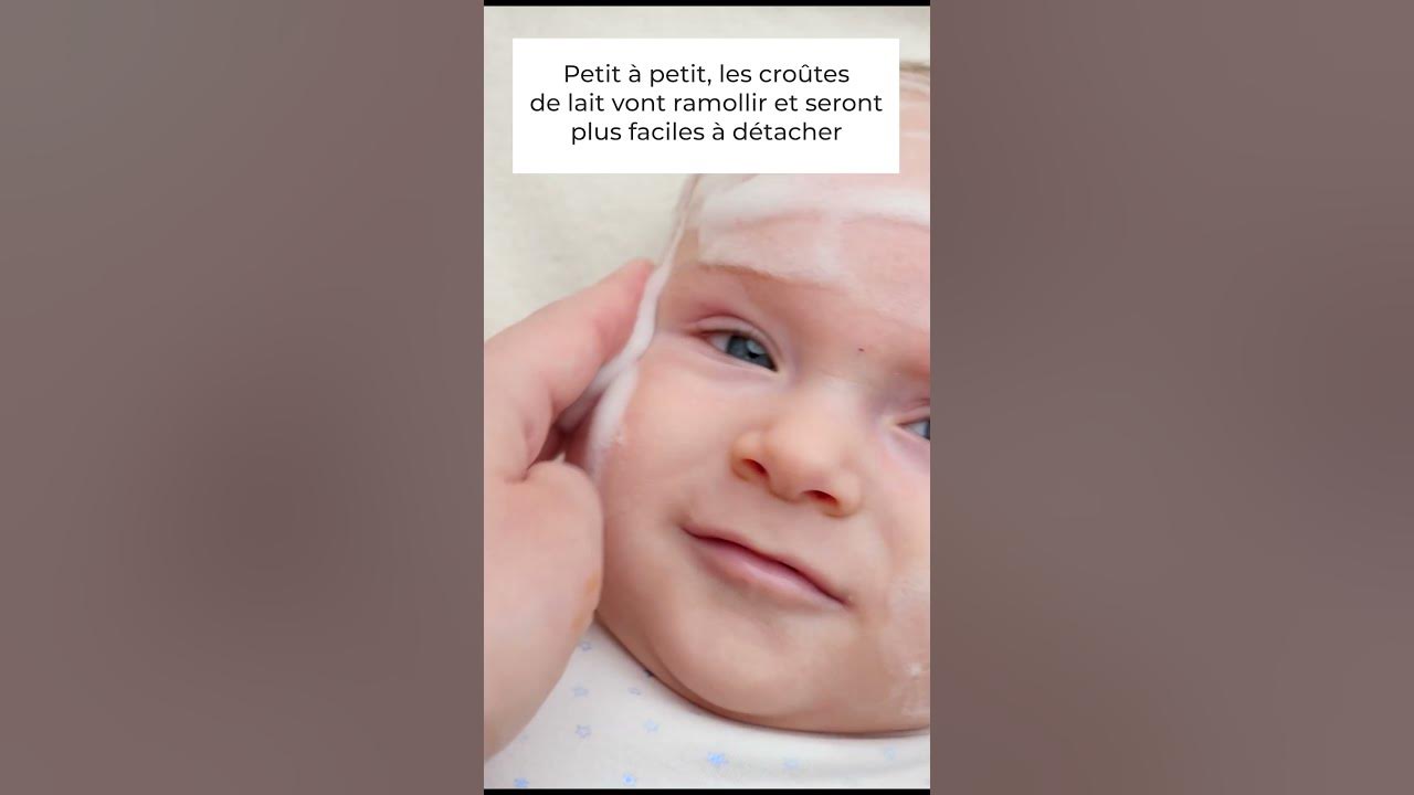 Video thumbnail for 👶 Croutes de lait : comment s'en débarrasser ?🍼