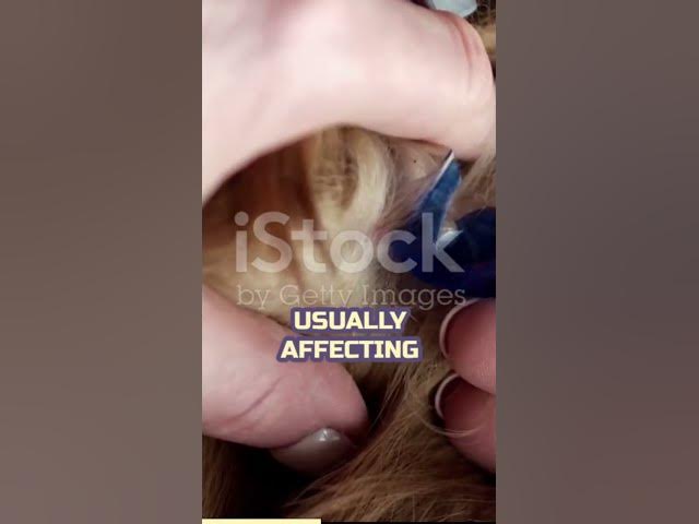 'Video thumbnail for American dog tick'