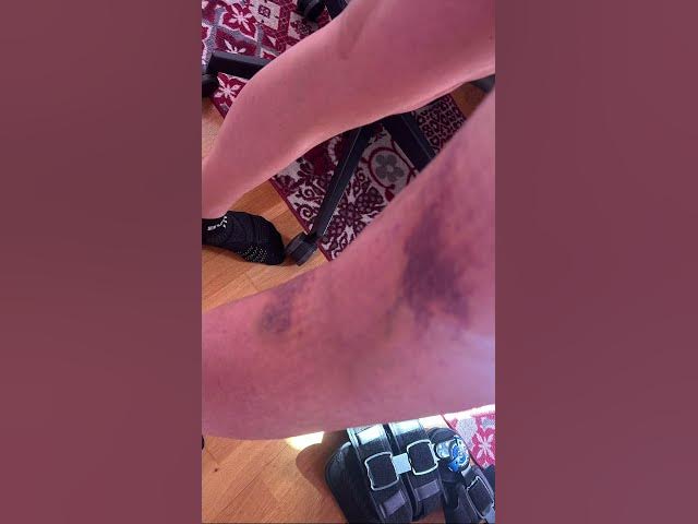 Video thumbnail for #rage ðŸ˜