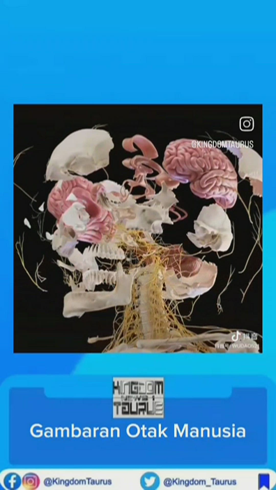 Video thumbnail for Gambaran otak manusia