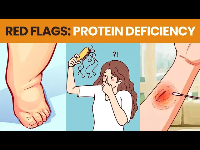 'Video thumbnail for Protein Deficiency Symptoms - You Need to Know | 8 Signs of Low Protein'